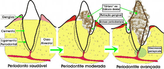coreldp.jpg
