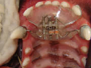 Ortodontia
